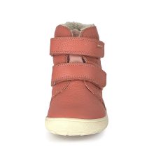 PROTETIKA DOROTY BEIGE