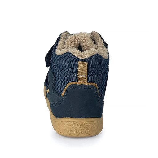 PROTETIKA DOROTY BEIGE