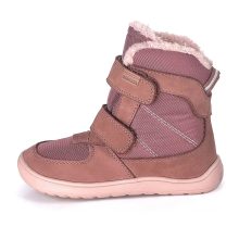 PROTETIKA DOROTY BEIGE