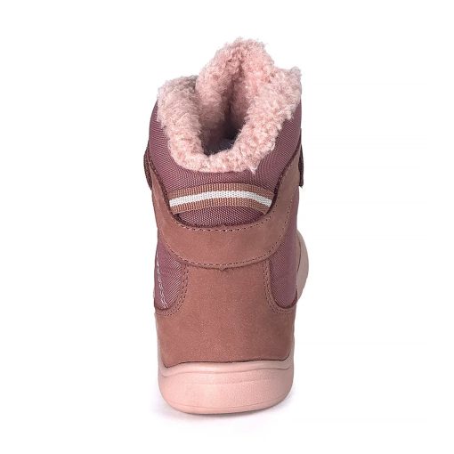 PROTETIKA DOROTY BEIGE
